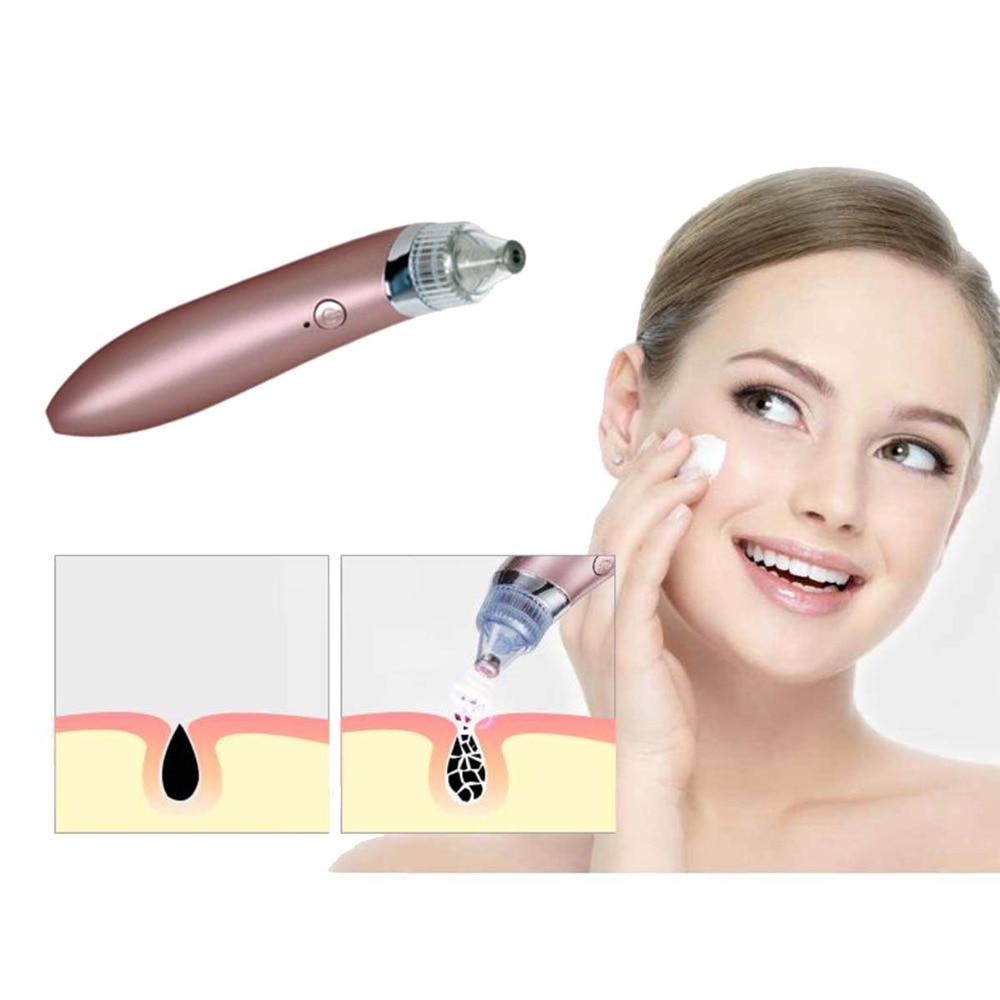 Face Pore Cleaner Blackhead Remover Vacuum Machine