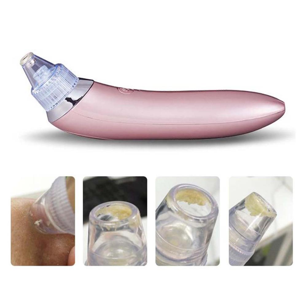 Face Pore Cleaner Blackhead Remover Vacuum Machine